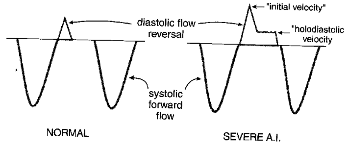File:Aodescflow.png