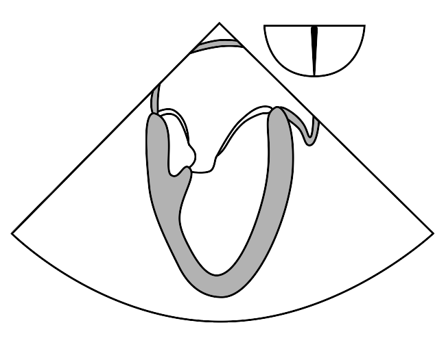 File:ME two-chamber.svg