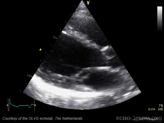 File:MV artefact.gif