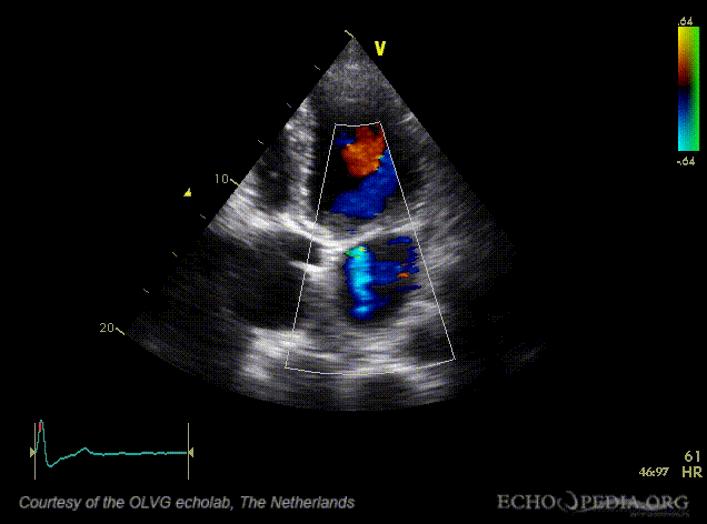 File:MKV lekkage01.gif