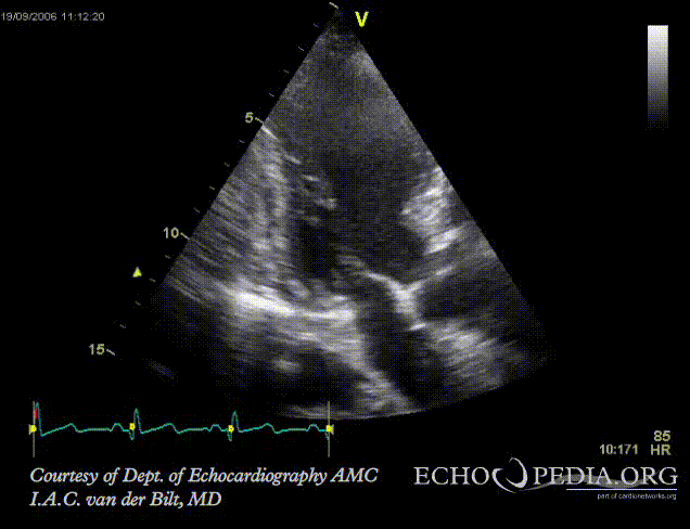 File E00919 gif Echopedia