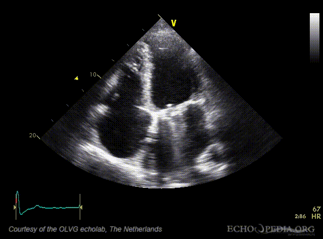 File:Rocking valve01.gif