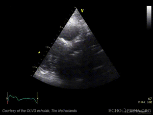 AoAsc mobiele structuur01.gif