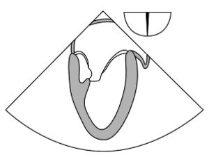 Anatomy me two chamber thumb.svg