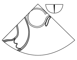 UE aortic arch SAX.svg