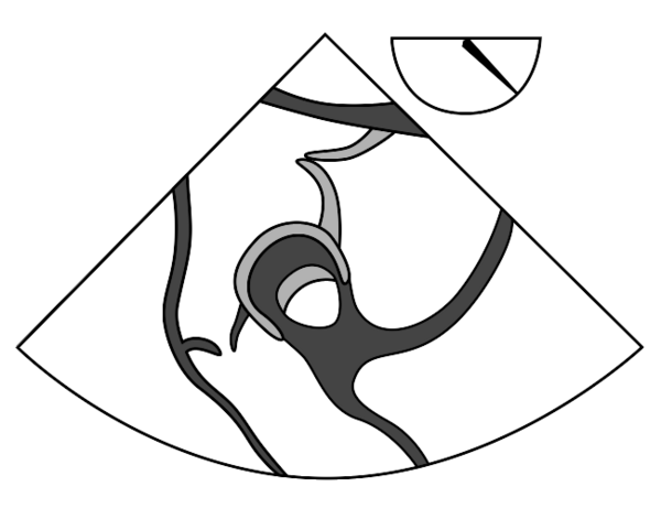 TEE - standard imaging views - Echopedia