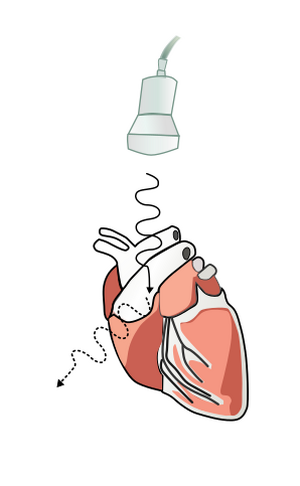 PhysicsUltrasound Fig19.svg