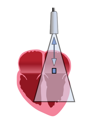PhysicsUltrasound Fig34a.svg