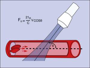 PhysicsUltrasound Fig33.svg