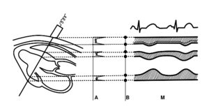 PhysicsUltrasound Fig28b.svg