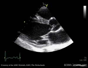 Comp 1 - Cinepak Codec.gif