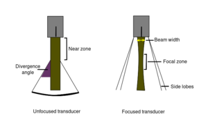 PhysicsUltrasound Fig25.svg