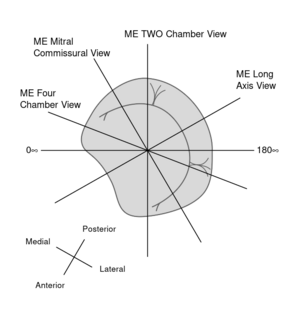TEE mitral valve2.svg