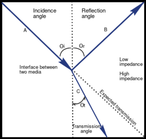 PhysicsUltrasound Fig18.svg