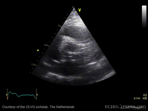 AoAsc mobiele structuur02.gif