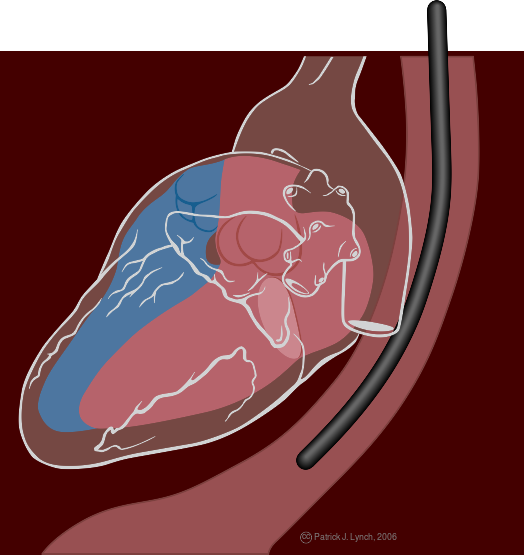 File:Transesophageal echocardiography diagram.svg
