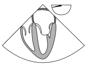 ME four chamber.svg
