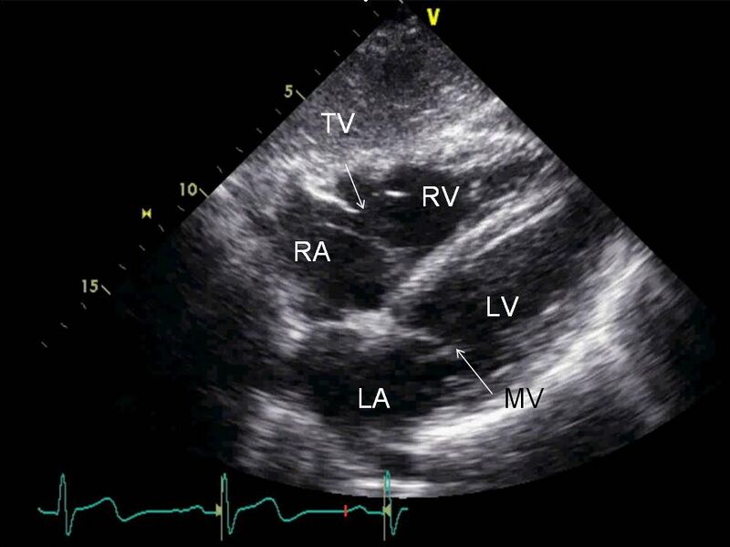 File:BasicsOfImagingFig18b.jpg