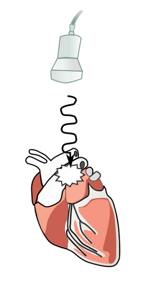 PhysicsUltrasound Fig11.svg