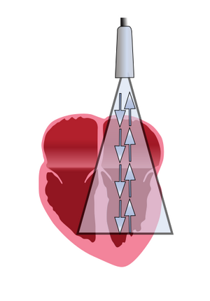 PhysicsUltrasound Fig33a.svg