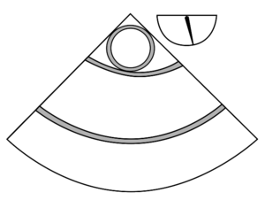 ME asc aortic LAX.svg